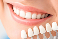 dentmahal