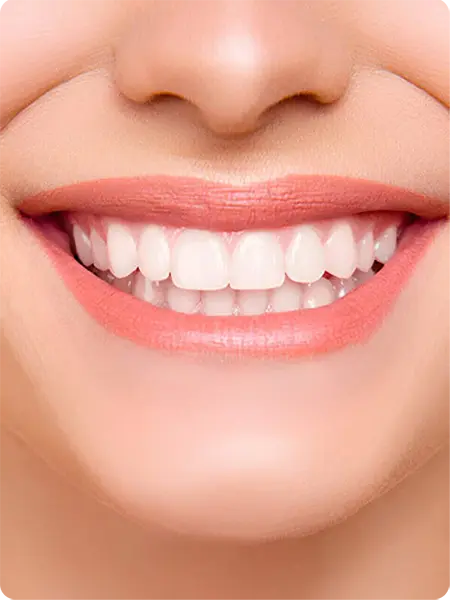 estetik gülüş tasarımı